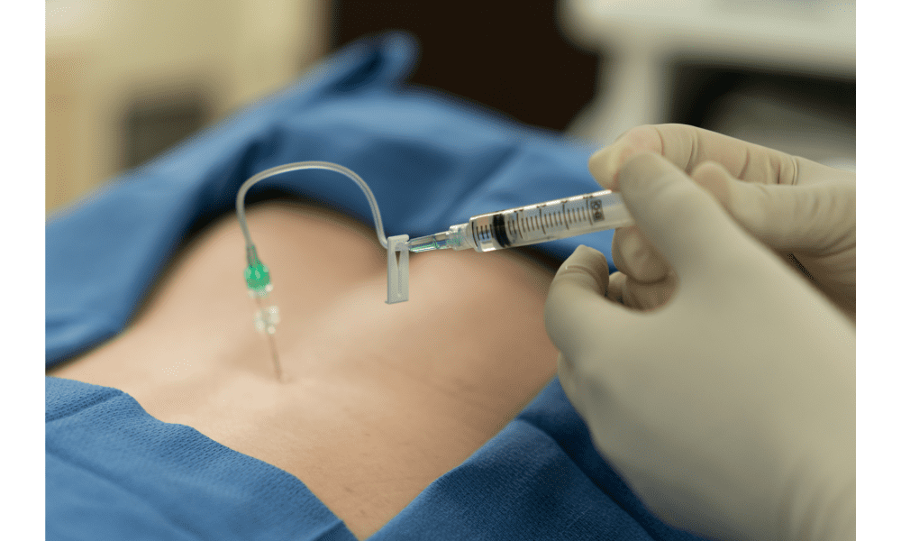 Epidural Steroid Injections